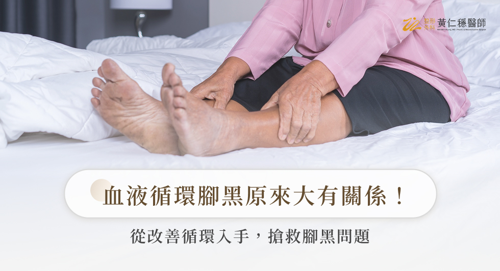血液循環腳黑原來大有關係！從改善循環入手，搶救腳黑問題