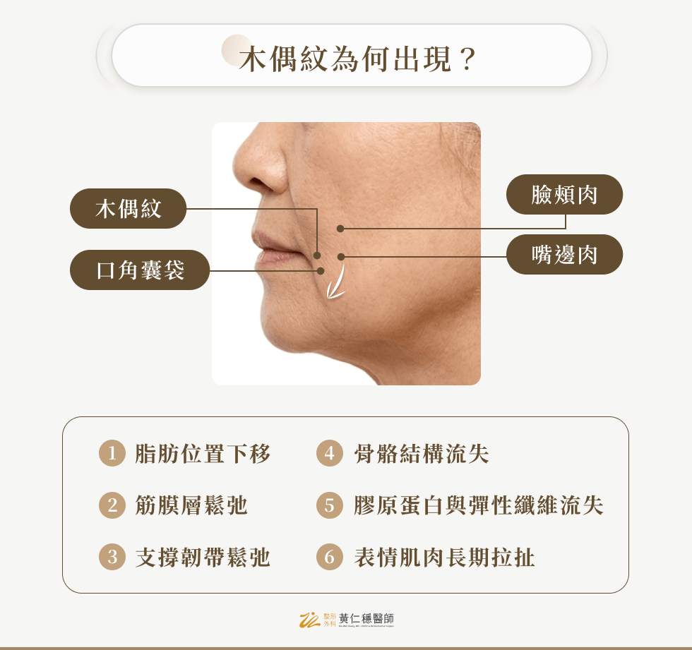 木偶紋為何出現？