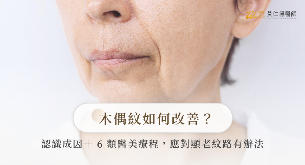 木偶紋如何改善？認識成因＋6類醫美療程，應對顯老紋路有辦法