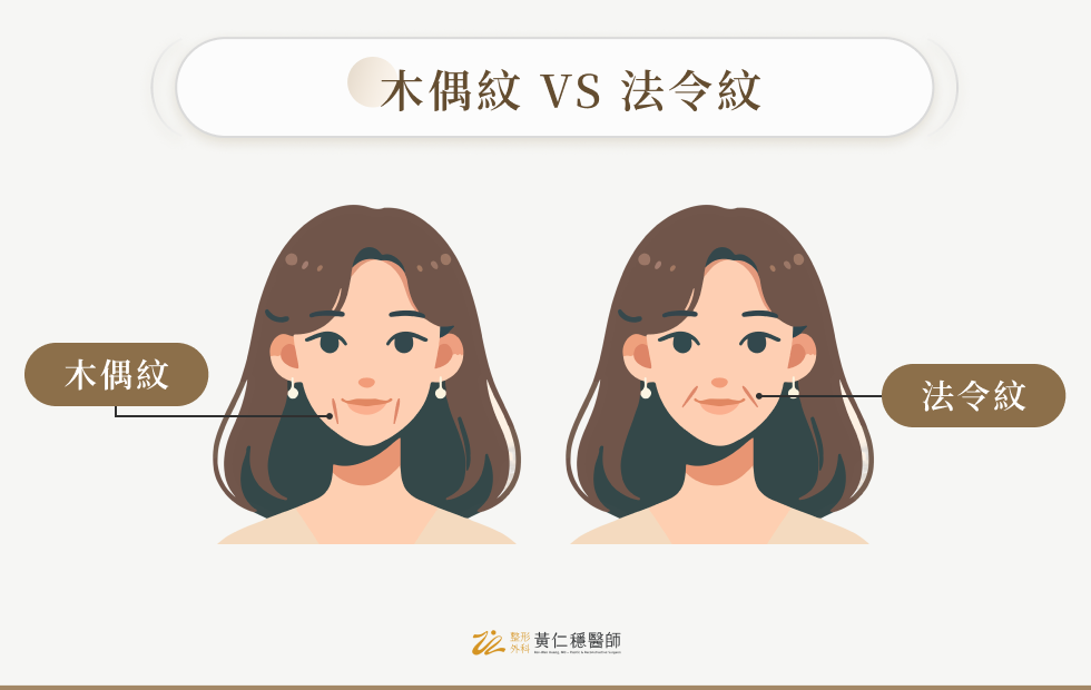木偶紋 VS 法令紋